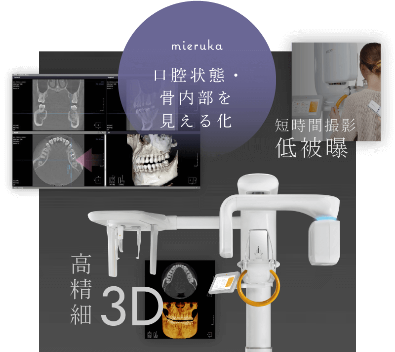 口腔状態・骨内部を見える化／短時間撮影 低被曝／高精細3D