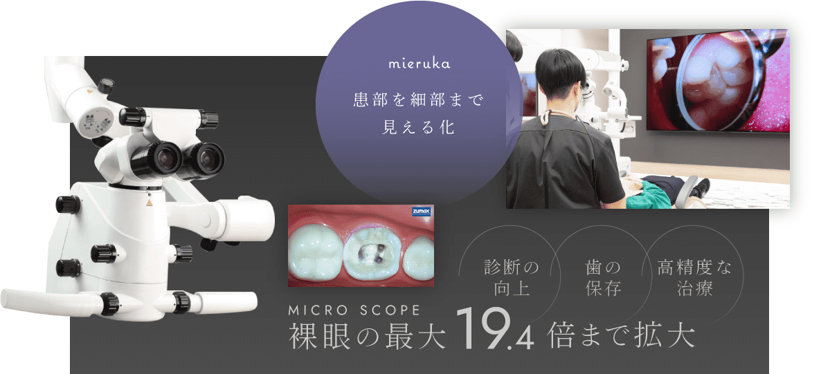 患部を細部まで見える化／裸眼の最大19.4倍まで拡大 診断の向上・歯の保存・高精度な治療