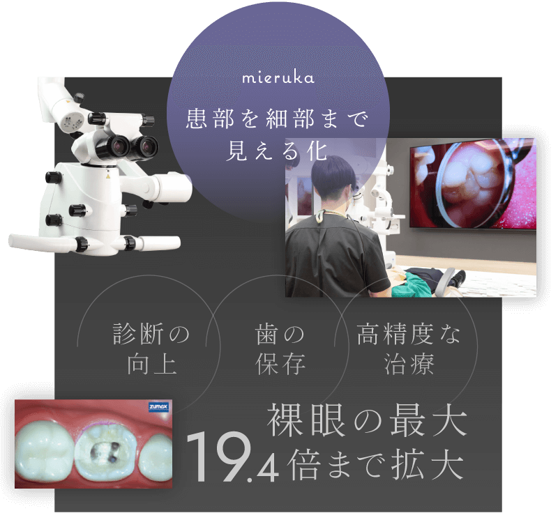 患部を細部まで見える化／裸眼の最大19.4倍まで拡大 診断の向上・歯の保存・高精度な治療