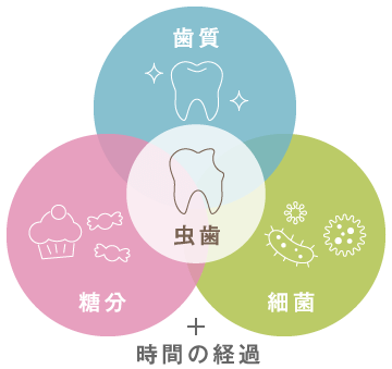 虫歯の原因は「歯質」「糖分」「細菌」と時間の経過