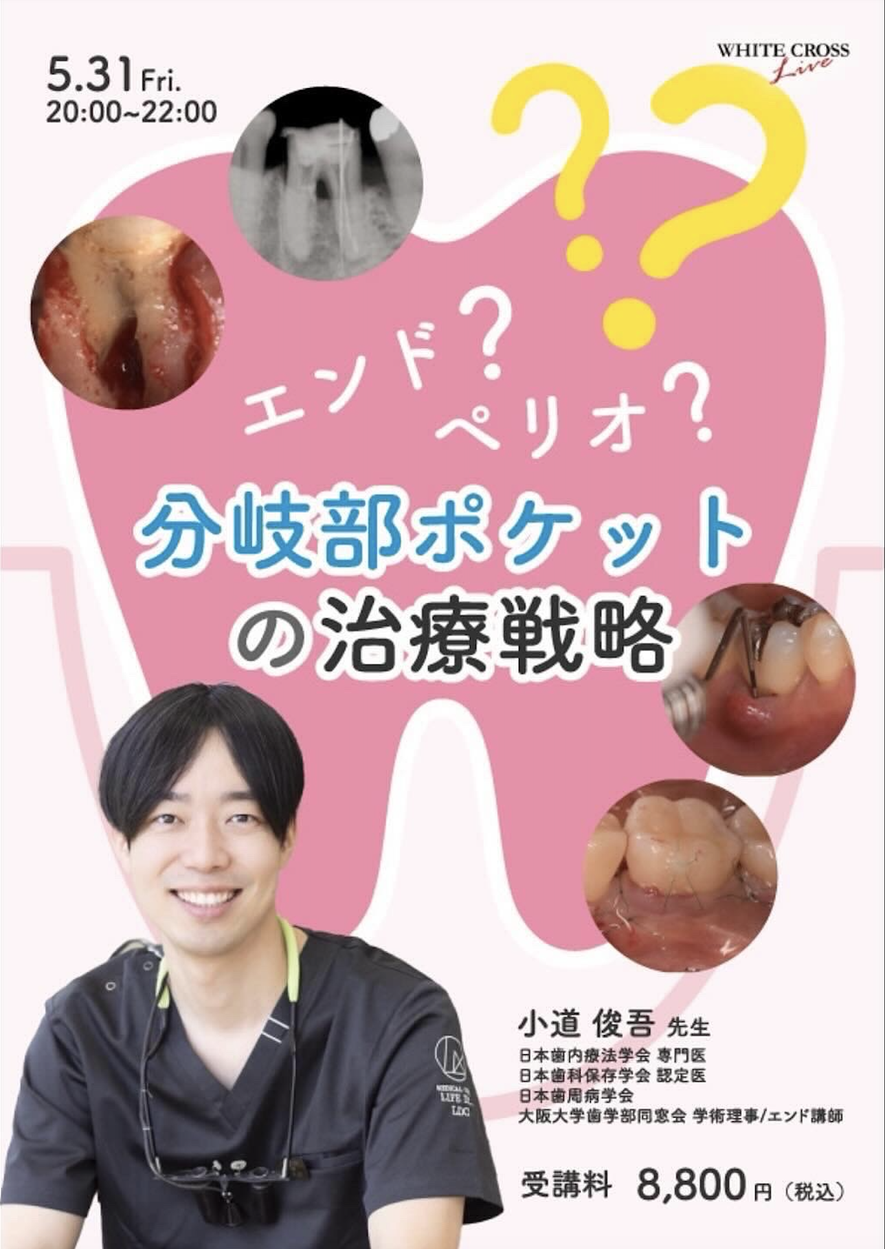裁断済み　ペリオの臨床戦略を学ぶ歯周動的治療