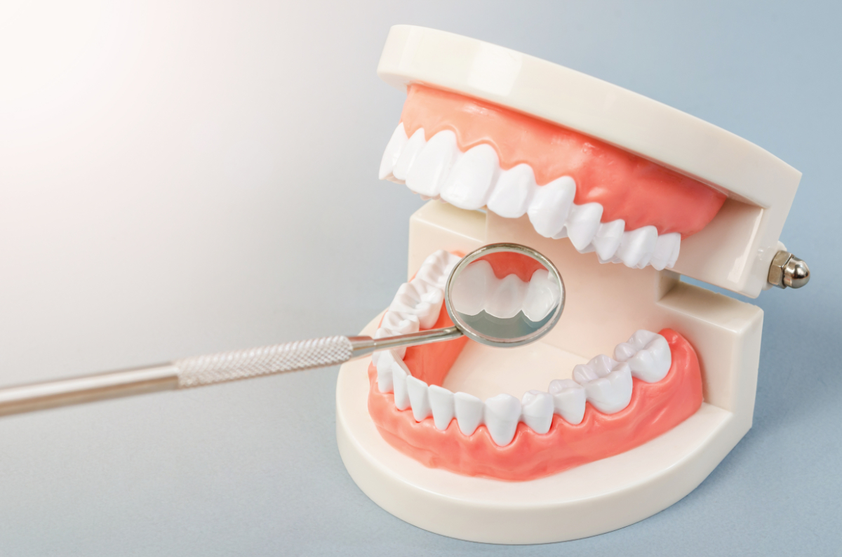 歯の模型と歯鏡