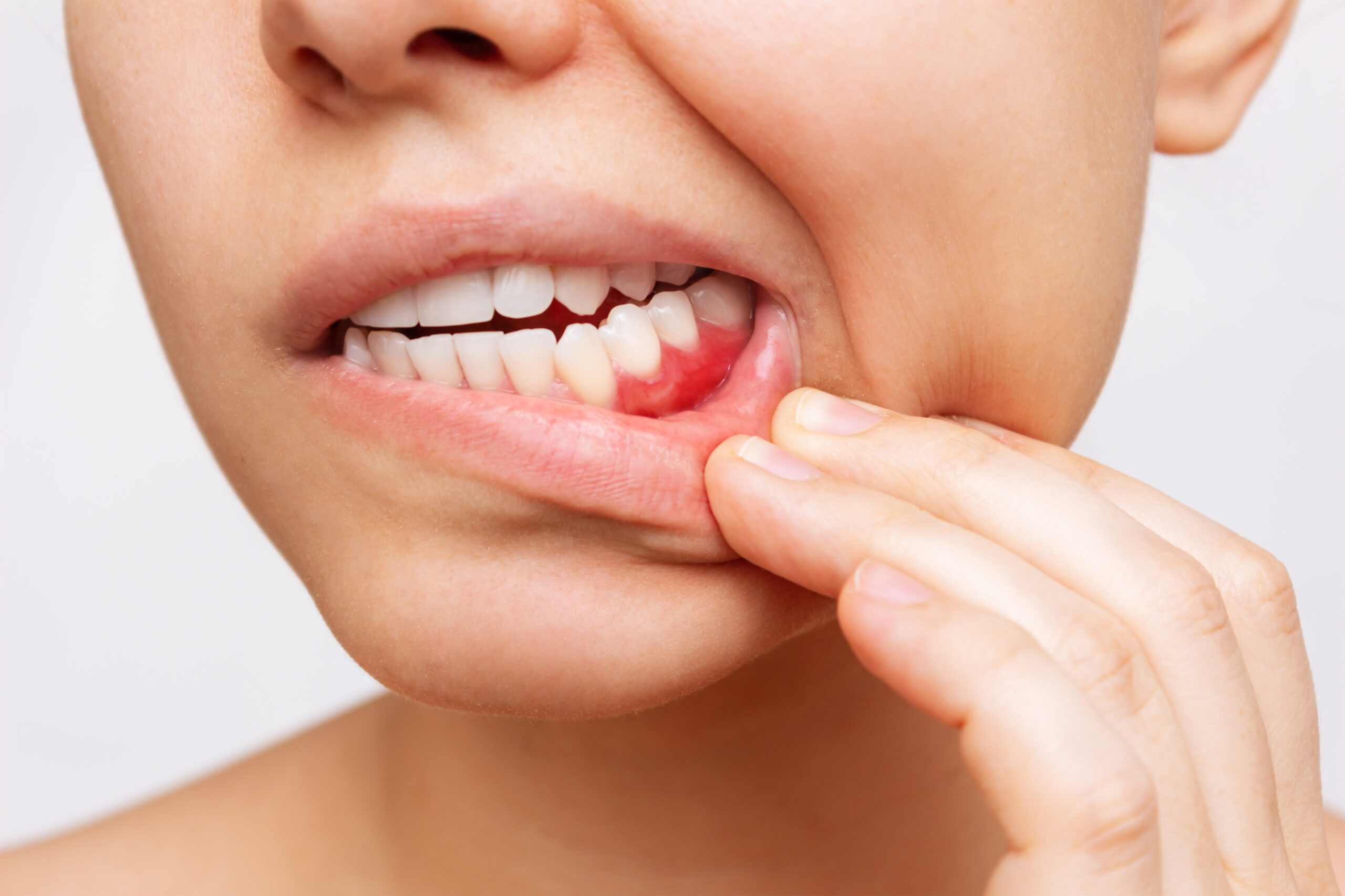 唇をめくって歯茎の状態を確認する女性