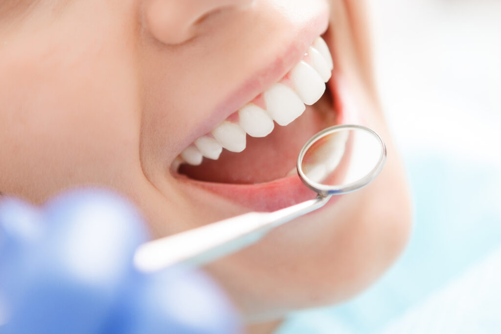 歯科用器具で歯を確認する女性