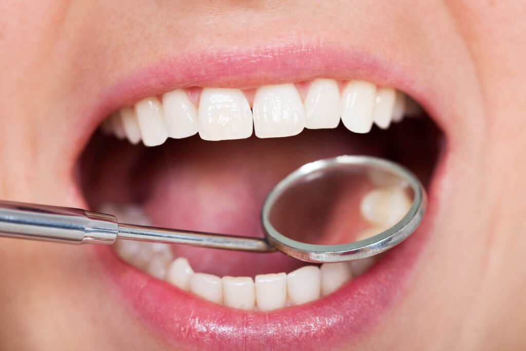口内を歯科用器具で確認される人