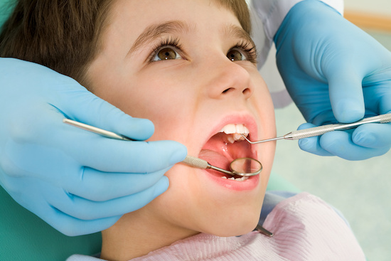 歯肉炎の治療を受ける子供