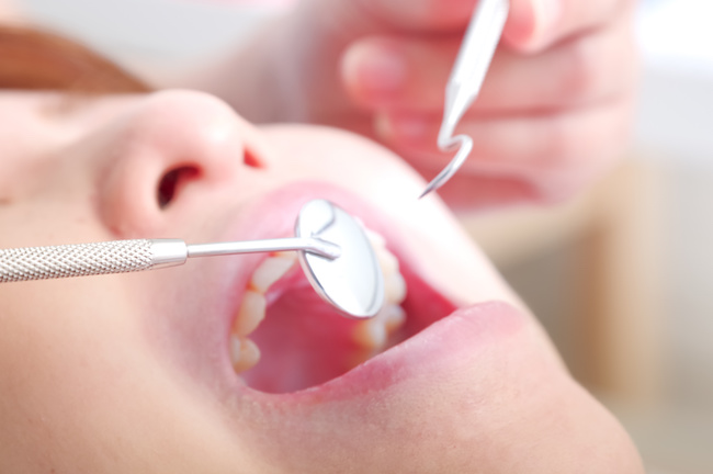 虫歯治療を受ける女性