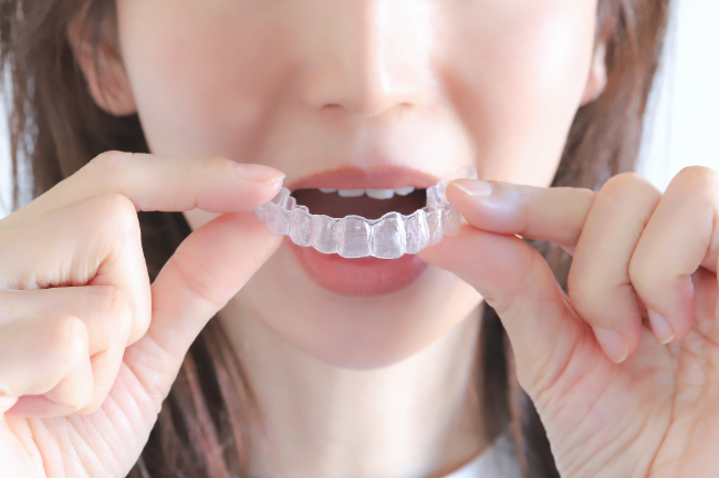 マウスピース型リテーナーを装着する女性