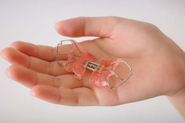 子どもの手のひらにのった床矯正の装置