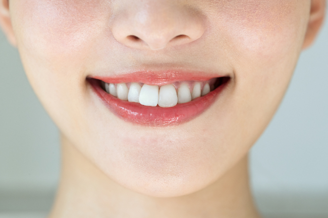 出っ歯の女性の口元